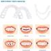 Buy Artificial Temporary Teeth | Cosmetic Veneers & Braces Prostheses for a Perfect Smile - Buy Online on GoSupps.com