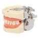 Upper jaw cyst dental model soft gum-forming centory model 28 teeth the Fe jaw frame for the practice of abscessing