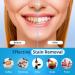 Bledras Teeth Whitening Kit Refill - 10 PCs Professional Tooth Bleaching Gel with LED Light & Soothing Gel - Safe & Effective Whitening - Buy Online on GoSupps.com
