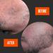 Beard Growth Kit - Microneedle Derma Roller & Biotin Oil for Thicker Beards | Natural Beard Comb Included - Vanilla Scent - Buy Online on GoSupps.com