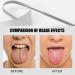 Buy Suliudaji Stainless Steel Tongue Cleaner Set - 2-Piece Tongue Brush for Fresh Breath & Oral Hygiene | Ideal for Adults & Children - Buy Online on GoSupps.com