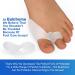 Bukihome Upgraded Pack of 10 Bunion Cushions Protectors - Bunion Corrector and Toe Spacer Set for Big Toe Bunion Relief - Gel Shield for Men & Women (Transparent) - Buy Online on GoSupps.com