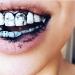 Blkdiamond Premium Activated Charcoal Teeth Whitening Powder - Natural Coconut Charcoal - Safe for Enamel - Whitens and Brightens Smile - Organic Carbon Toothpaste Detoxifier - Buy Online on GoSupps.com