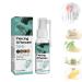 Anti Tinnitus Earwax Removal Spray Anti Cochlear Blockage Removal Spray Ears Earwax Removal Spray Tinnitus Relief for Ringing Ears Ear Wax Softener Cleaner (1 Pieces)