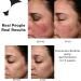 PRIORI Skincare Gel Perfector for Acne & Oily Skin | Salicylic & Lactic Acid Treatment | Oil Control Blemishes & Wrinkles | Fragrance Free 1 fl oz - Buy Online on GoSupps.com