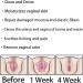 AnnieCare Instant Anti-Itch Detox Slimming Products - Natural Viginal Gel & Capsules (10Box) - Buy Online on GoSupps.com