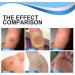 24Pcs WartRemover Pads Foot Corn Removal Plaster with Hole Penetrates and Removes Common and Plantar Warts 2023 New Warts Off Removal Pads for All Skin Types - Buy Online on GoSupps.com