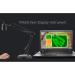 Adjustable Vein Viewers for Nurses | USB Camera Imaging IV for Accurate Venous Access | Ideal for Adults | Enhance Vein Puncture Success - Buy Online on GoSupps.com