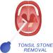 Tonsil Stone Remover Tool - Effective Almond Stones Caster Glass for Oral Hygiene | Mandelsaugers Tonsillenstein Remover for Mouth Cleaning - Buy Online on GoSupps.com