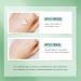 Anti Acne Face Cream Tea Tree Acne Cream for Acne Treatment & Spot Treatment Spot Cream Soothing Ance Gel for Blemishes Blackhead Remover Acne Moisturiser Reduces Redness Oil Control - Buy Online on GoSupps.com