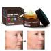 Anti-Wrinkle Face & Neck Retinol Cream with Hyaluronic Acid - Premium Anti-Aging Face Moisturizer - Anti Aging Firming Facial Cream to Reduce Wrinkles Dark Spots Fine Lines Sun Damage