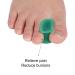 Toe Separator & Spacer - 8 Pairs Hallux Valgus Corrector for Pain Relief | Relax & Align Toes - Buy Online on GoSupps.com