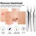 BBASILIYSD Ultra-fine Professional No. 5 Acne Blackhead Removal Care Beauty Salon Pimples Cleaner Skin Face Clip Deep Q4J0 Twe Needles Tool Bend Clamp - Buy Online on GoSupps.com