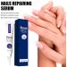 Flysmus 7 Days Nail Recovery Rapid Growth Essence Pen Natural 7 Days Nail Growth and Strengthening Serum Nail Growth & Strengthening Oil Serum for Thin Nails and Growth 20ml (1PC) - Buy Online on GoSupps.com