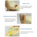Human Ear Model Professional Ear Simulation Model 6X Magnification Human Organ Model Ear Model 5-Piece Medical Education Model - Buy Online on GoSupps.com