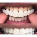 YTXY Cosmetic Teeth Prostheses - Instant Veneers & Dental Silicone Temporary Tooth Whitening | 2 Pairs for Denture Repair & Brace Covers - Shop Now! - Buy Online on GoSupps.com