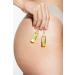 Rilastil - Stretch mark treatment - Pack of 10 ampoules of 5 ml - Buy Online on GoSupps.com