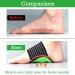 CCAIPU Arch Support Pads Thick Cushioned Compression Foot Arch Support with Arch Comfort Pad for Flat Feet Heel Spurs Pain Relief Fallen Arches for Women & Men - Buy Online on GoSupps.com