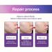 Pimples Patch - Buy Online on GoSupps.com