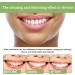 Buy Tlopa Ampoule Toothpaste & Gel - 20 Disposable Essence for Whitening & Plaque Removal | International Shipping - Buy Online on GoSupps.com