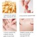 Pore Minimizer Correxion Hyaluronic Acid Night Serum Capsules Face Skin Moisturiser Manicure Tackle - Buy Online on GoSupps.com