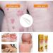 HePbAK Youth Bee Venom Psoriasis Treatment Cream | Professional Soothing Moisturizer for All Skin Types | 3PCS - Buy Online on GoSupps.com