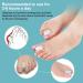 RooRuns Toe Separators for Overlapping Toes & Bunions - Gel Orthopedic Bunion Corrector & Relief - Large Size (3 Pair) 6pcs White - Buy Online on GoSupps.com