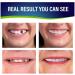 MOMBIY Teeth Veneer - Natural Shade Cosmetic Teeth Enhancer | 2pcs White Accessories for Confident Smile - Buy Online on GoSupps.com