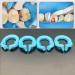 Buy Wudaizhi 4pcs Dental Resin Clamp Ring Separator - Contoured Metal Matrix Holder Autoclavable - International Shipping - Buy Online on GoSupps.com