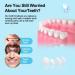 Temporary Tooth Repair Kit | Moldable Fake Teeth | Thermal Beads Replacement | Regain Confidence | W2 Tooth Repair Kit (White) - Buy Online on GoSupps.com