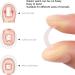 Ingrown Toenail Corrector Strips 10pcs Ingrown Toe Nail Strips Painless Paronychia Straightening Corrector Patches(Heavy effort) - Buy Online on GoSupps.com