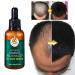 Hair Growth Serum with Ginger Oil - Anti-Hair Loss Thickening & Quick Growth - 30ml for Thinner Hair - Buy Online on GoSupps.com