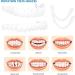 Buy Gimly Teeth Set - Top & Bottom Lightening Dentures for Men & Women | 6 Pairs of Plug-In False Teeth & Veneers - Buy Online on GoSupps.com