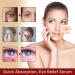 Chalazion Eye Treatment & Blepharitis Relief - 30ml Under Eye Serum for Dark Circles Puffiness & Moisturizing Eyelids - Buy Online on GoSupps.com