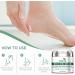 Urea 40% Foot Cream - Cracked Heel Repair Cream - Foot Cream for Cracked Heels and Dry Skin - Urea Cream for Feet with Tea Tree Oil Aloe Vera and Chamomile for Deep Moisturizing - Buy Online on GoSupps.com