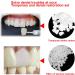 Temporary Tooth Repair Kit - Moldable Fake Teeth & Thermal Fitting Beads for Quick Tooth Replacement | White Teeth Repair Solution - Buy Online on GoSupps.com