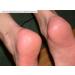 Natural Products Black Callus Ex - Effective Callus Remover & Foot Cream 100ml | Fast International Shipping - Buy Online on GoSupps.com