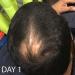 Biotin Hair Growth Conditioner 33.8oz - High Potency Anti-Hair Loss Formula with Vitamins E, A, and C for Fastest Results - Buy Online on GoSupps.com