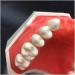 Vinbcorw Dental Care Model - 24 Removable Teeth for Adult Teaching (12x9.5 cm) - Ideal for Dentists & Educators - Buy Online on GoSupps.com