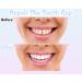 Temporary Tooth Repair Beads for Chipped Teeth - Dental Filler for Missing/Broken Teeth (50g) - Buy Online on GoSupps.com