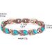 Yinox Copper Magnetic Bracelet for Women - Natural Blue Turquoise Healing & Lifting Ideal Gift for Sister Wife Mother (18.5 cm) - Buy Online on GoSupps.com