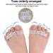Bunion Corrector Toe Separators - 2 Pairs Silicone Gel Toe Straighteners for Overlapping Toes, Hallux Valgus, and Foot Pain Relief - Men and Women - Buy Online on GoSupps.com