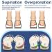 Urwalk Adjustable Supination & Over Pronation Corrective Insoles - 6 Pieces (Beige) - Buy Online on GoSupps.com
