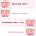 Infant Hernia Belt 2pcs - Pink | Newborn Umbilical Cord Hernia Care for Baby | Navel Protection Belt - Buy Online on GoSupps.com