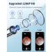 Ear Wax Removal Tool Camera 1296p Otoscope | Rechargeable Wireless Smart Endoscope for Earwax Removal - Blue - Buy Online on GoSupps.com