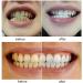 Buy Hfdhd Dentures Pebble - Temporary Cosmetic Teeth & Removable Prostheses for Men & Women - Comfortable Upper & Lower Veneers (9 Pairs) - Buy Online on GoSupps.com