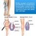 Medical Compression Stockings 20-30 mmHg for Men & Women - Gradient Support for Varicose Veins & Circulatory Health | XXL Beige - Buy Online on GoSupps.com