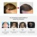 MKKENLEY Magic Hair Growth Tonic with Ginseng for Fast Hair Growth | Best Treatment for Men and Women with Baldness | Nourishing Scalp and Anti-Hair Loss Formula for Hair Regrowth - Buy Online on GoSupps.com