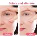 Smoothing Silicone Patches Silicone Facial Wrinkle Patch Reusable Home Beauty Skin Firming Wrinkle Smoothing Patches - Buy Online on GoSupps.com