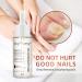 Lurrose Nail Repairing Serum 20ml - Onychomycosis Softening Solution for Discolored Nails - Nails Treatment Oil for Damaged Nails - Buy Online on GoSupps.com